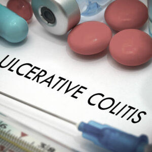 5 Foods That Help Manage Ulcerative Colitis and Crohn’s Disease