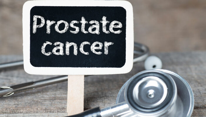 Causes, Symptoms, and Ways to Manage Prostate Cancer